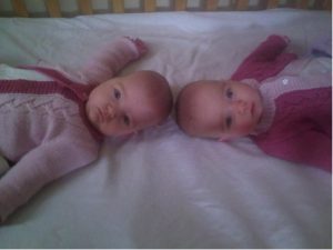Sutherland twins at 6 months