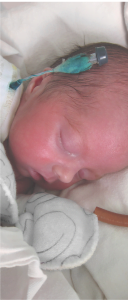 Newborn with a CVC