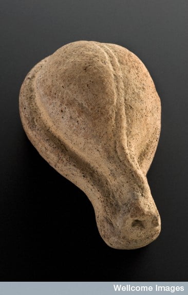 Votive offering in the shape of a bladder, Roman, 200 BCE-20