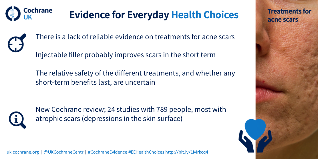 Acne scars blogshot #EEHealthChoices