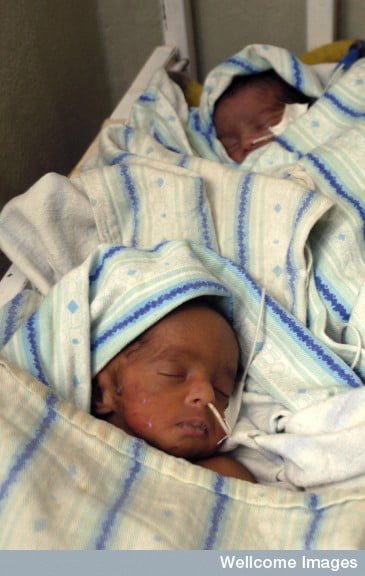 Care of twin newborn infants, Ethiopia