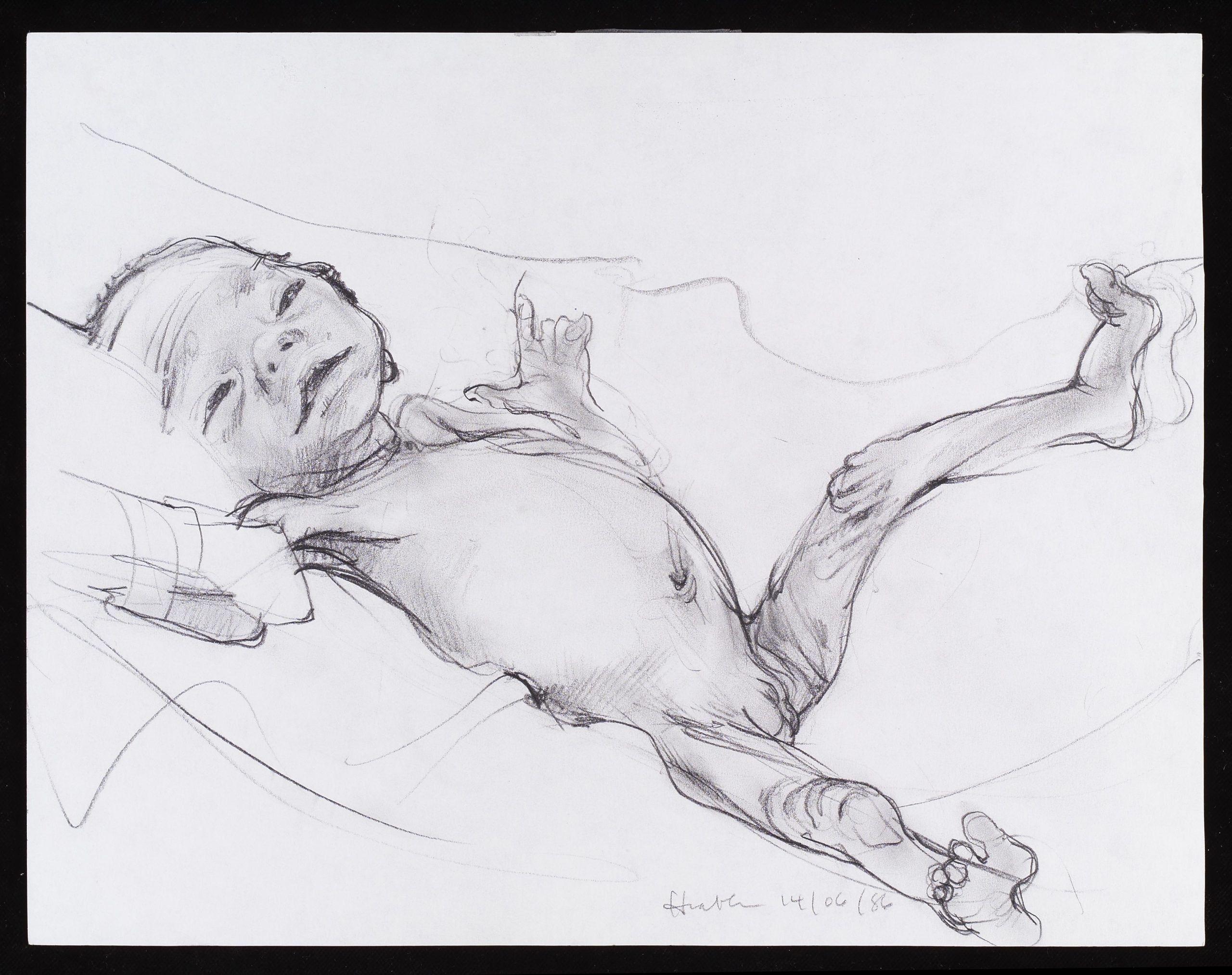 drawing of preterm baby