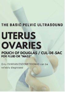 The basic pelvic ultrasound. Uterus, overaries. Pouch of Douglas / Cul-de-sac for fluid or 'mass'. Only ovarian endometriosis can be reliably diagnosed