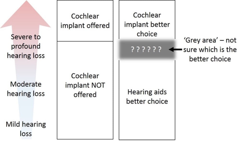 Grey area - not sure which is the better choice (between hearing aids and a cochlear implant) for individuals close to having severe to profound hearing loss