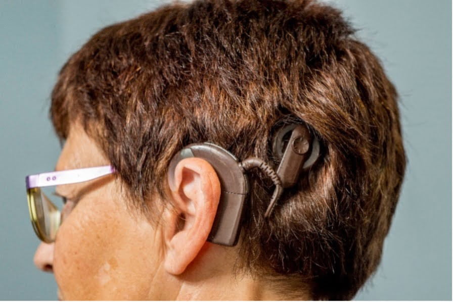 Woman wearing a cochlear implant