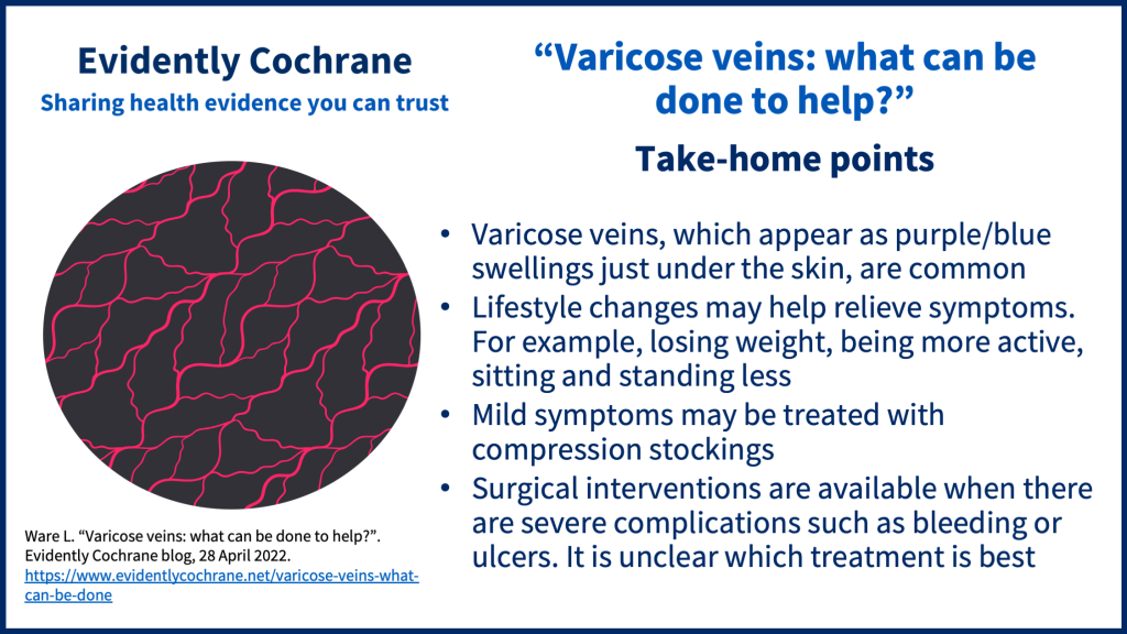 Varicose veins, which appear as purple/blue swellings just under the skin, are common • Lifestyle changes may help relieve symptoms. For example, losing weight, being more active, sitting and standing less • Mild symptoms may be treated with compression stockings • Surgical interventions are available when there are severe complications such as bleeding or ulceration (the development of ulcers). It is unclear which treatment is best