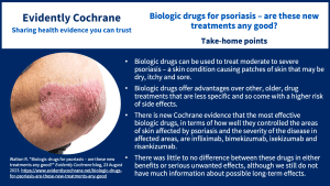 Biologic drugs can be used to treat moderate to severe psoriasis – a skin condition causing patches of skin that may be dry, itchy and sore. Biologic drugs offer advantages over other, older, drug treatments that are less specific and so come with a higher risk of side effects. There is new Cochrane evidence that the most effective biologic drugs, in terms of how well they controlled the areas of skin affected by psoriasis and the severity of the disease in affected areas, are infliximab, bimekizumab, ixekizumab and risankizumab. There was little to no difference between these drugs in either benefits or serious unwanted effects, although we still do not have much information about possible long-term effects.